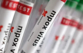 Sobe para 140 número de casos confirmados de Mpox no país, em 2026