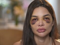 Dentista relata ao ‘Fantástico’ agressões que sofreu do marido, empresário da Faria Lima