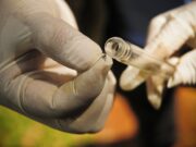 Após alta de 215% nos casos de doenças causadas pelo Aedes, Manaus dá início a vistoria em 25.711 imóveis