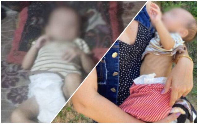 bebe-de-4-meses-desnutrido-e-r