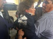 Explosivo atinge cabeça de deputada de Honduras durante entrevista
