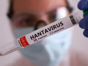 OMS descarta indícios de “surto maior” de hantavírus