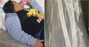 Mulher de 37 anos que fingiu ter 12 passou por internações psiquiátricas em unidades de saúde do Ceará