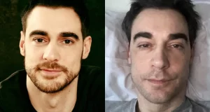 Ator Arnaud Denis é submetido a eutanásia aos 43 anos, confirma site