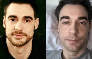 Ator Arnaud Denis é submetido a eutanásia aos 43 anos, confirma site